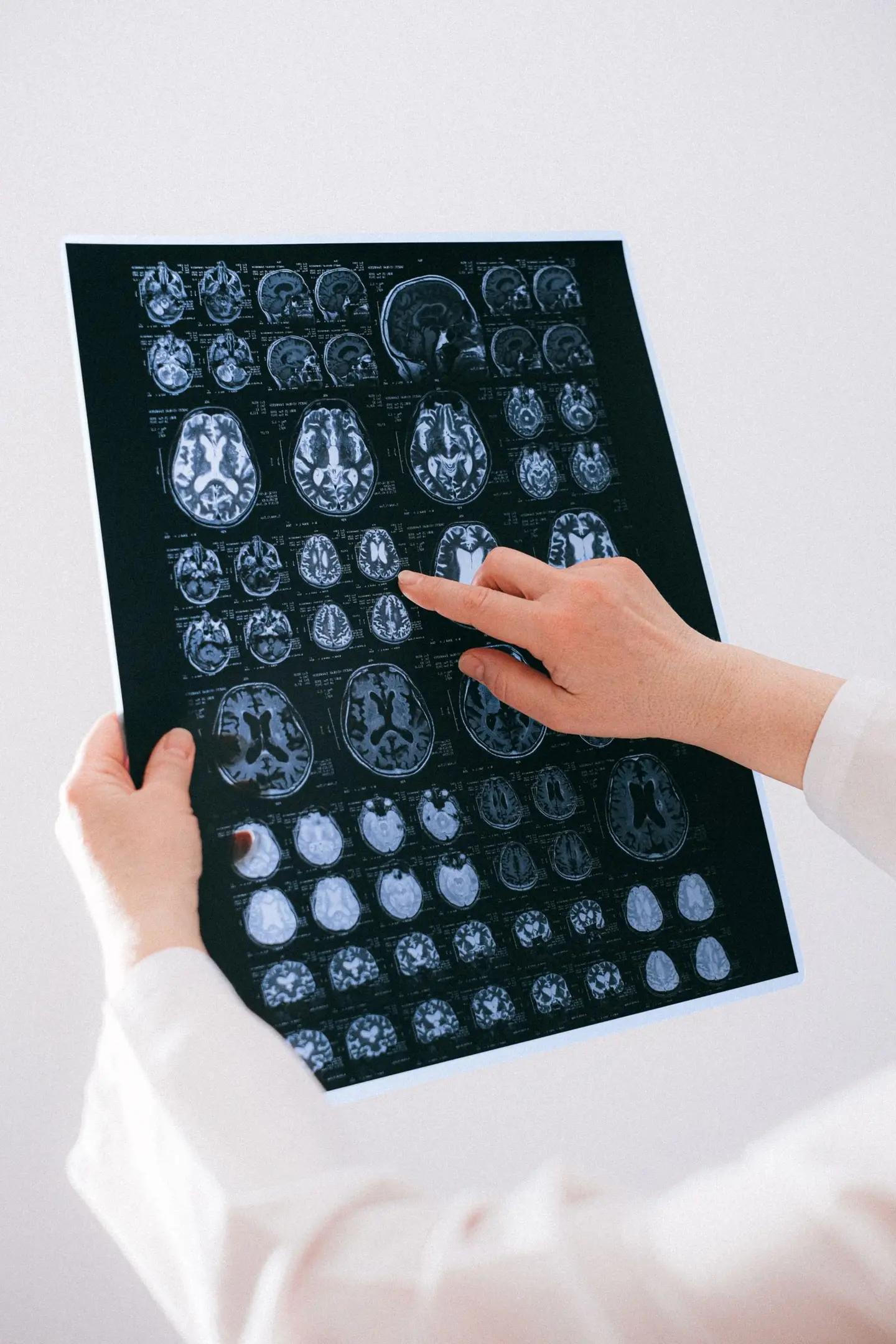 Neurología Pediátrica