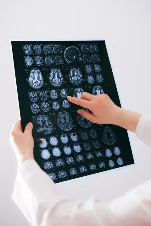 Neurología Pediátrica
