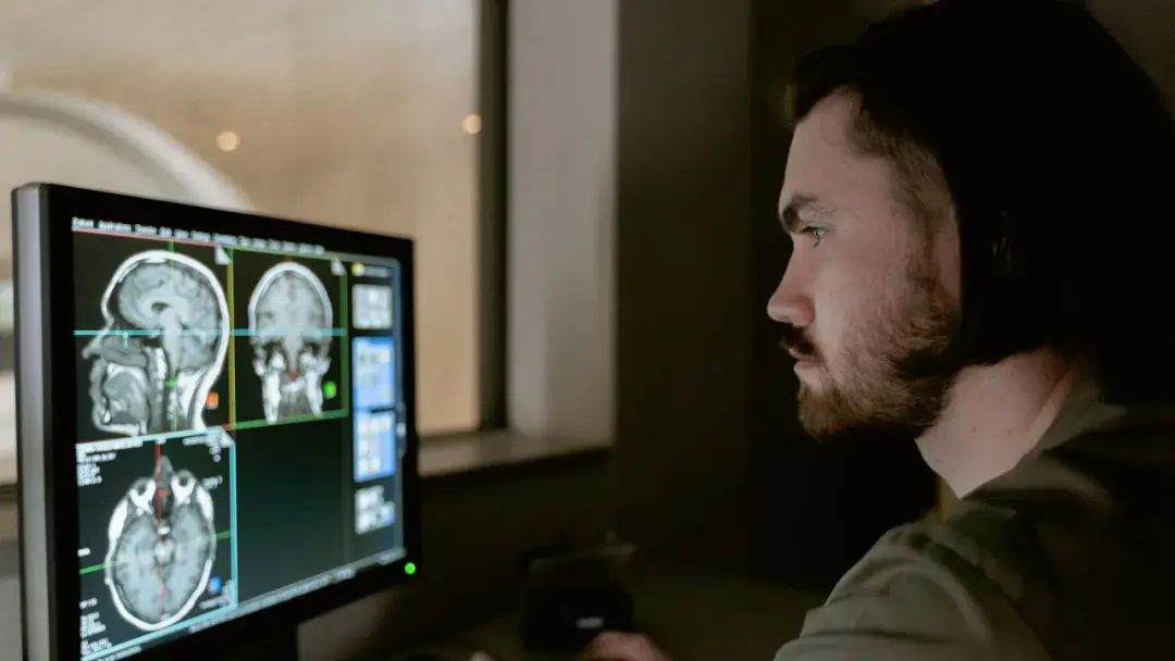 Médico radiólogo revisando imágenes del cerebro en un monitor