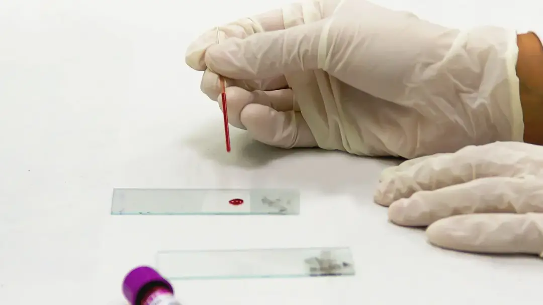 Muestra de sangre en una lámina de vidrio junto a un tubo de recolección con tapa morada